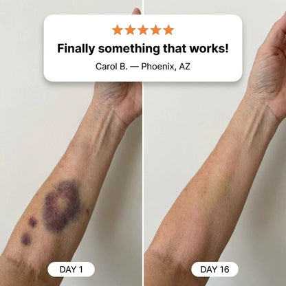 LOVEHERWM® Bruise Repair & Skin-Strengthening Cream