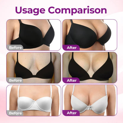👩‍⚕️Turonu® ✨✨Targeted Breast Enhancement Advanced Nano Microneedle Patch✨