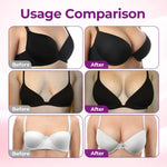 👩‍⚕️Turonu® ✨✨Targeted Breast Enhancement Advanced Nano Microneedle Patch✨