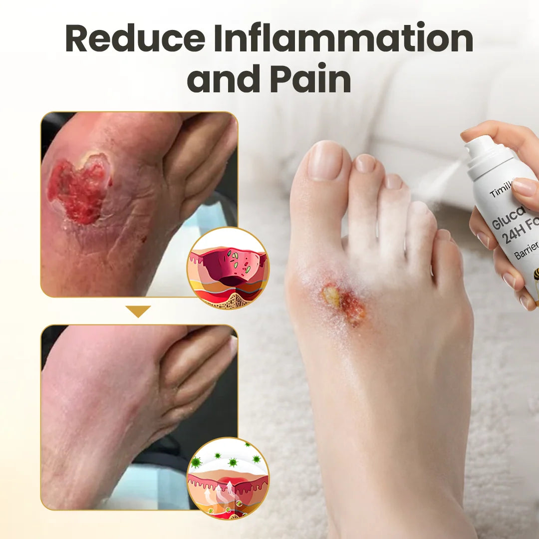 Timilk® GlucaVeil 24H Foot Barrier Spray