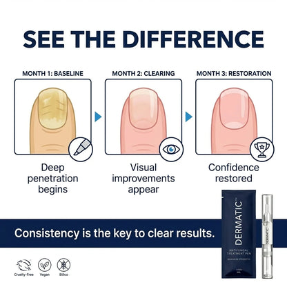 Your Nail Isn't Treatment-Resistant.