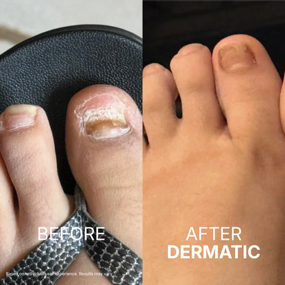 Your Nail Isn't Treatment-Resistant.