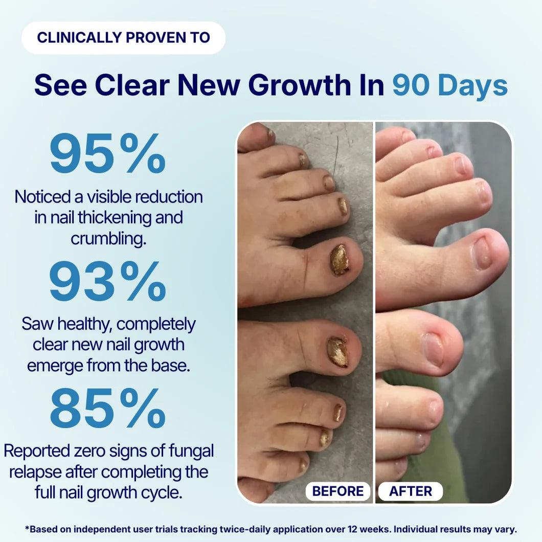 Your Nail Isn't Treatment-Resistant.